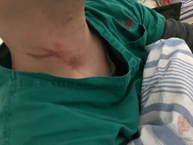 武汉两名参与新型肺炎救治医生被患者家属打伤 